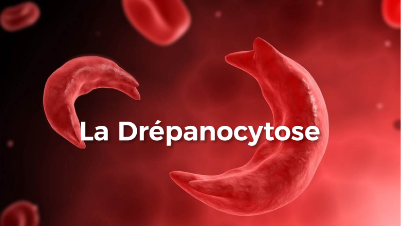 Le Togo en première ligne contre la drépanocytose : sensibilisation, dépistage et partenariats internationaux